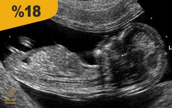 مرکز تصویربرداری دکتر کابلی (زنجان)